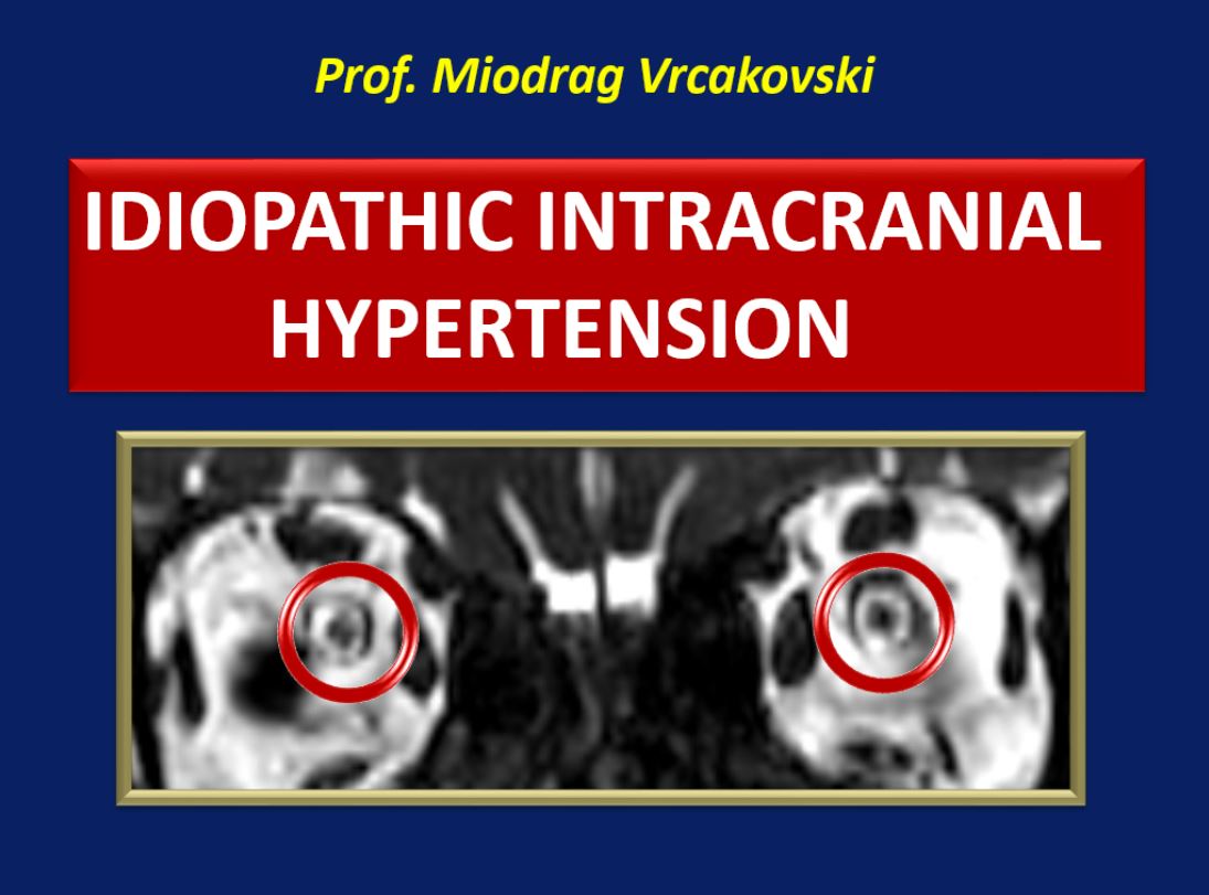 Idiopathic Intracranial Hypertension